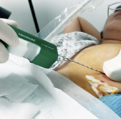 doctor, ginecólogo, oncólogo, enfermedad, mama